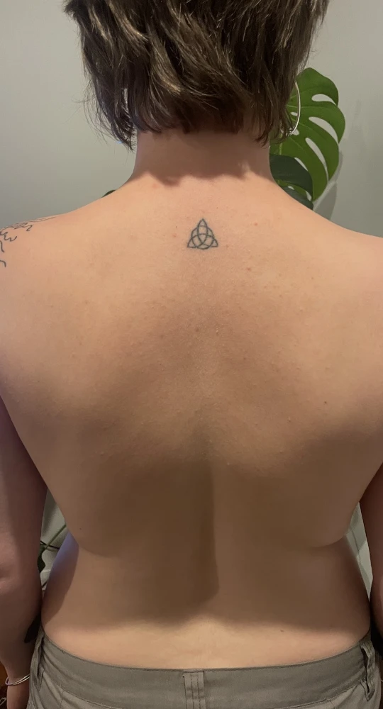 Skin Hives Healed